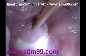 Flier semen cum on every side cervix thither distention bawdy cleft speculum